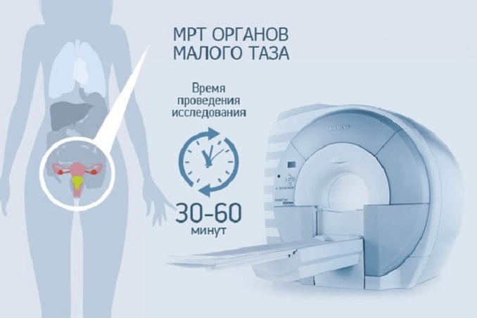 процедура проведения мрт малого таза