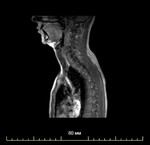 МРТ шеи и сосудов, сделать в Москве, цена на МРТ шеи и сосудов, запись