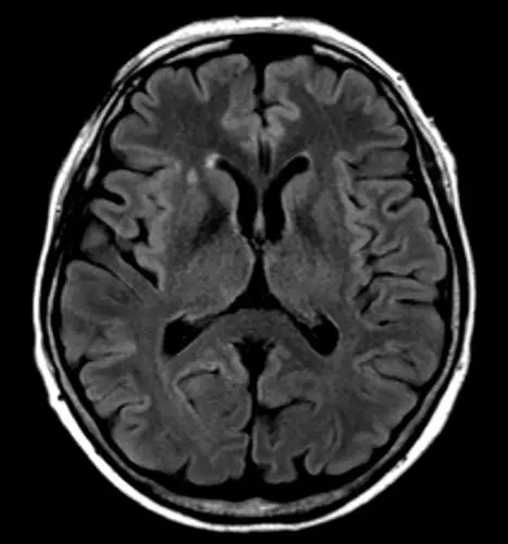 Кт головы москва. Снимки мрт головы здорового человека. Покажи нормальный снимок головного мозга на мрт. Фото мрт мозга в норме. Мрт головного мозга у детей с расстройством аутистического спектра.