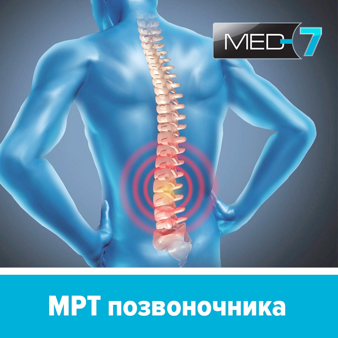 МРТ позвоночника