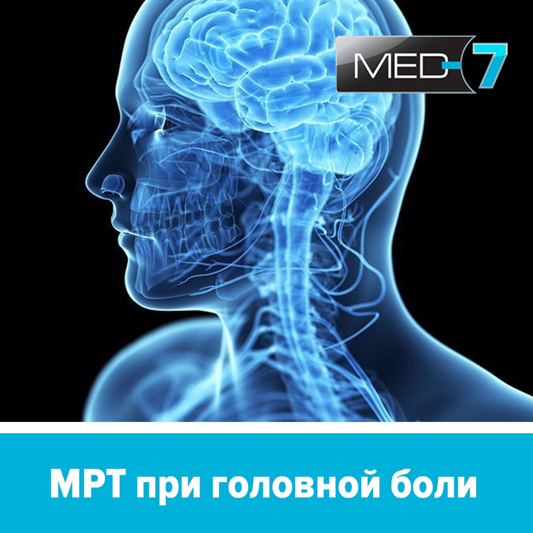 Диагностика головы